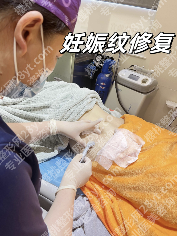 杭州妊娠纹哪家医院正规？修复医院红黑榜曝光，避坑必看！