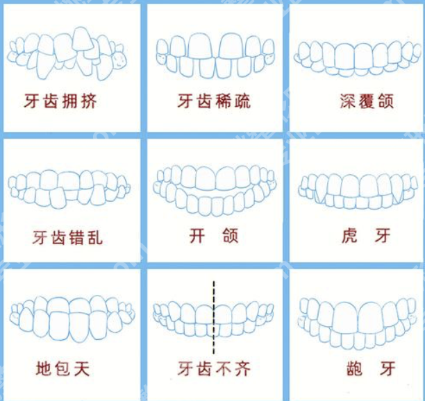 杭州第二人民医院牙齿矫正多少钱？学生党/上班族30秒对号入座