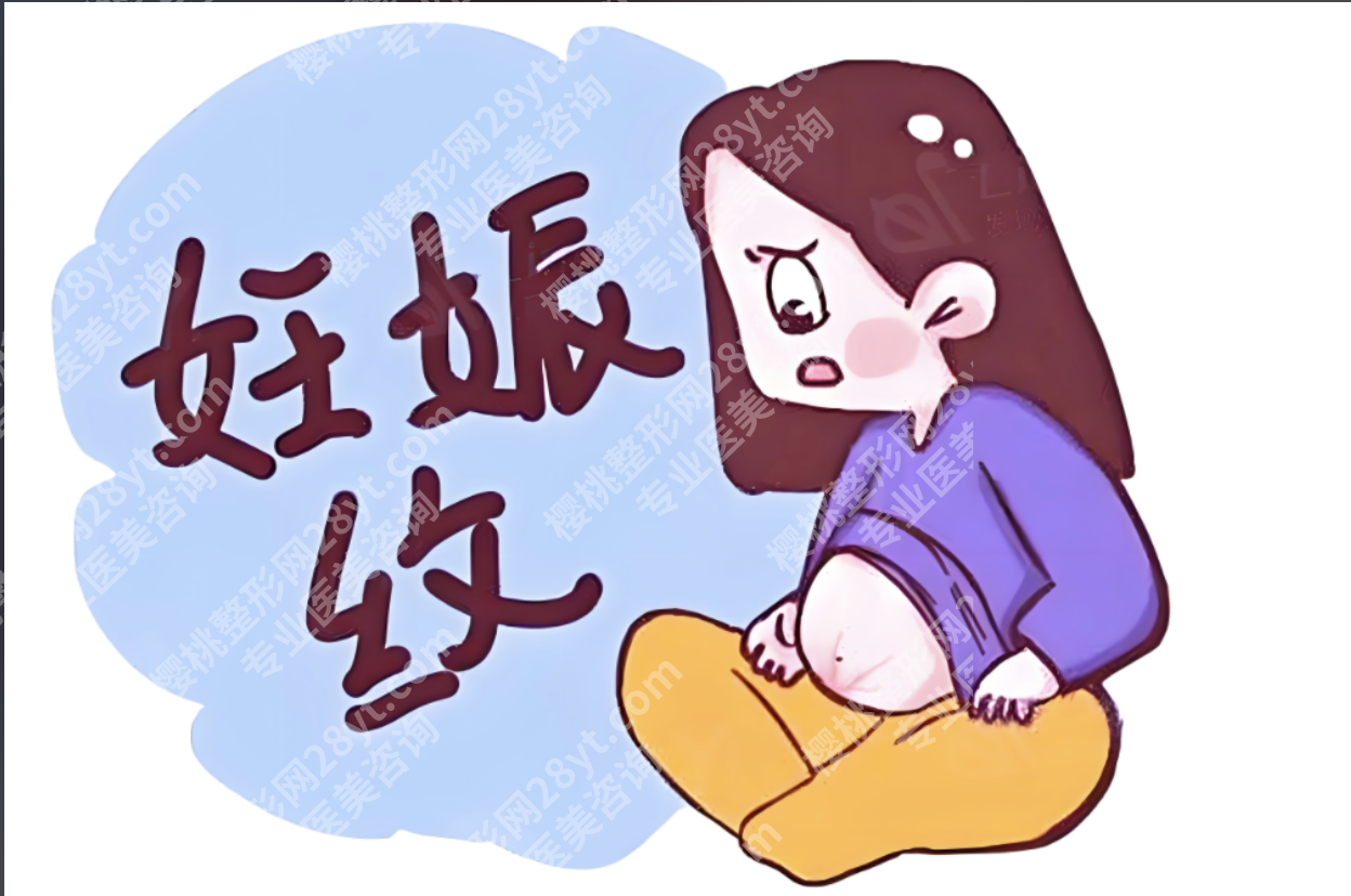 杭州妊娠纹修复哪家医院效果好？3家口碑医院深扒，白纹/紫纹选对方案淡化90%（附价格表）