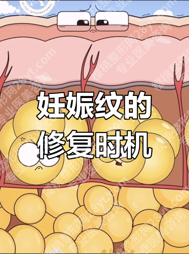 广州妊娠纹修复三甲医院：5家医院实测对比（附核心信息表）