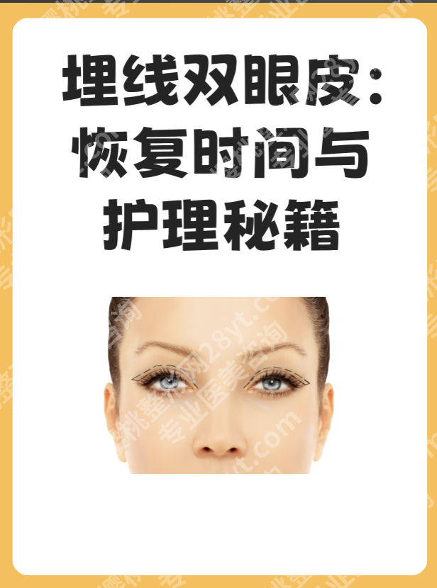 埋线双眼皮多久能恢复自然？这4个细节让你恢复快2倍