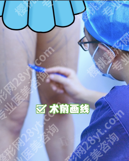 苏州腿部吸脂手术大概多少钱?哪家好?