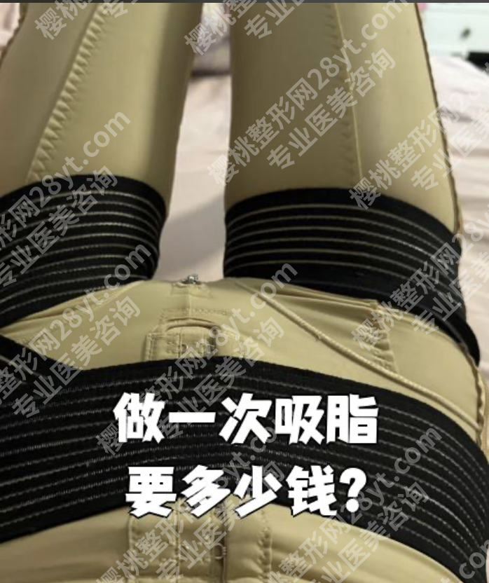 深圳瘦大腿吸脂多少钱？哪家好？