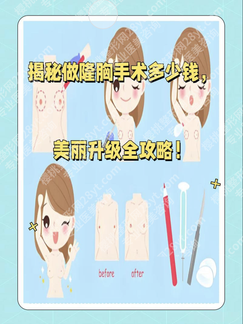 佛山第一人民医院隆胸多少钱？揭秘价格构成+真实案例，这篇帮你算明白