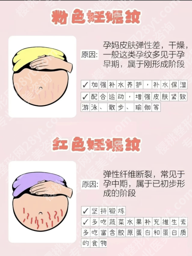 济南妊娠纹修复手术医院怎么选？3类靠谱机构+2 张避坑表，宝妈直接抄作业