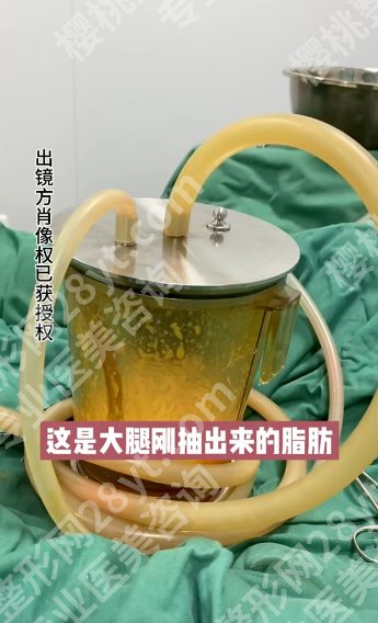 长沙哪家大腿抽脂医院好？内行人教你选对机构，轻松get漫画腿