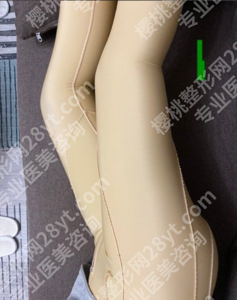苏州大腿吸脂价格2025参考+医院排名：专业人士为你详细解答
