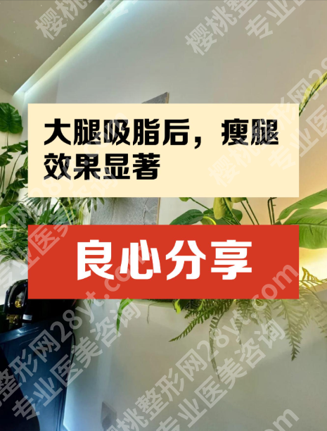 青岛大腿吸脂医院有哪些？今天就来给大家盘点值得推荐的口碑医院