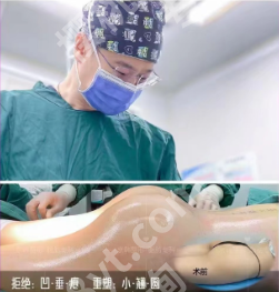 成都丰臀丰垮医美医院推荐：从技术到口碑，帮你找到靠谱机构