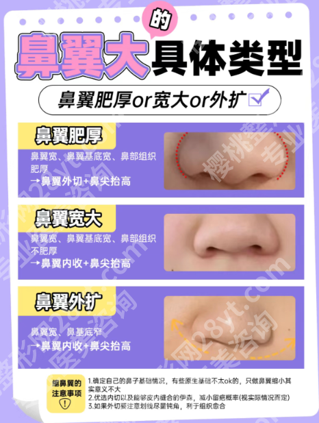 缩鼻翼外切太多了能接回去吗？分2种情况说清