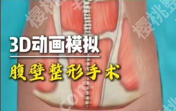 郑州腹壁整形手术厉害的三个医院：真实案例，看完不纠结