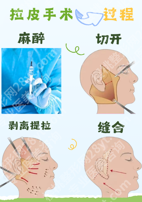 郑州面部拉皮排行榜前十：别信野榜，内行人拆5家硬核机构