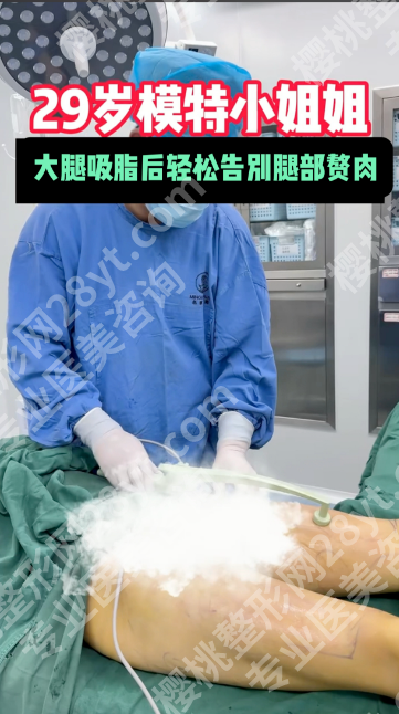 福州大腿吸脂正规医院选哪家？别信广告，5家正规机构+避坑攻略全公开
