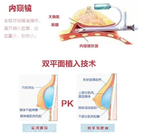 上海第九人民医院隆胸要排队多久？内行人揭秘，时间差竟差3个月