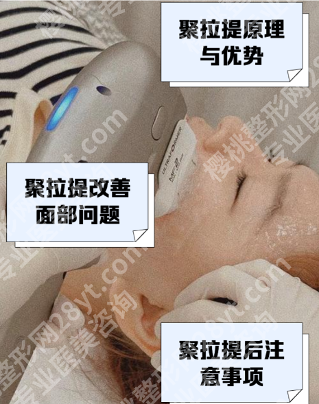 聚拉提有什么效果和副作用？ 3大核心效果，数据+案例说话