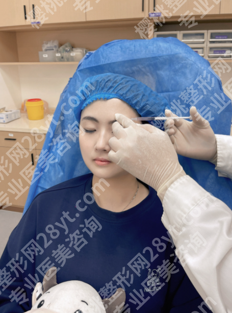 眉弓填充几天恢复自然？从肿胀到自然，7-30天蜕变手册