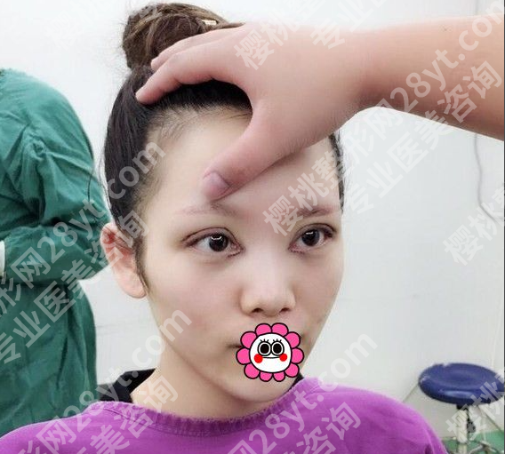 哈尔滨瑞丽哪个大夫割双眼皮好？3个硬标准比“名气”靠谱10倍
