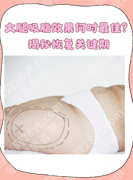 苏州大腿吸脂哪里好？评分榜：4家热门机构真实测评