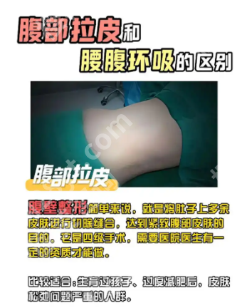 腰腹环吸和腹壁整形术有什么区别？90%的人分不清，一篇讲透核心区别