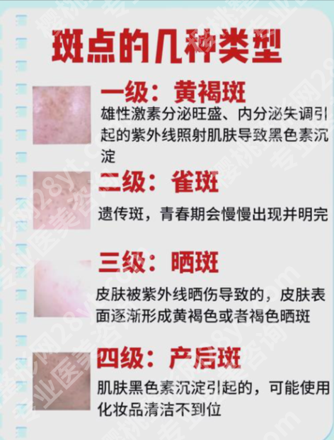 哈尔滨瑞丽祛斑好吗？4大硬核维度+真实案例，揭秘东北祛斑实力派真相