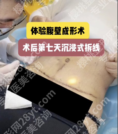 南京腹壁整形手术哪里做的好？3家TOP机构+2份硬核数据，帮你精准避坑