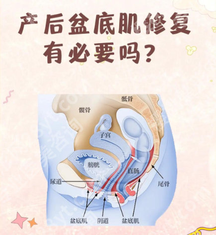 私密热玛吉可以修复盆底肌吗？2类人群实测+数据，产后妈妈必看