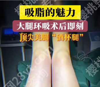 大腿吸脂和腹部吸脂哪个更疼？真实体验+数据拆解，怕疼星人必看