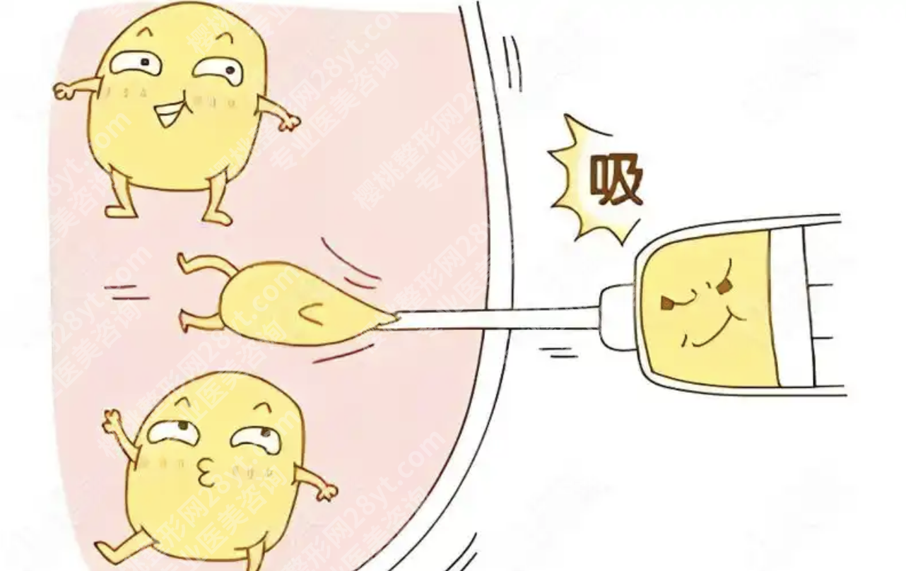 临沂吸脂好的医院排名：5家正规公立机构详解，附价格
