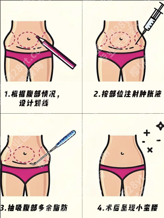 昆明抽脂肪去哪个医院？内行人揭秘6家宝藏机构