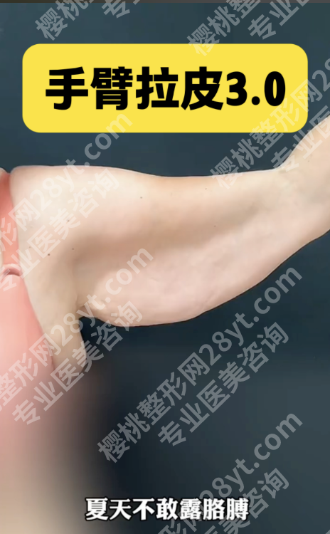 手臂拉皮腋下切口多久愈合？愈合周期+护理干货，藏住疤痕还不影响抬胳膊