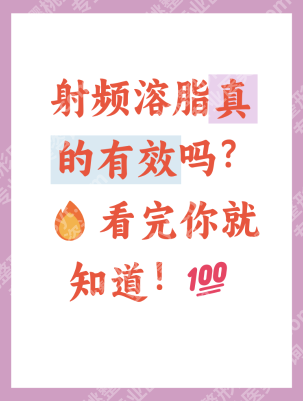 射频溶脂效果怎么样？过来人实话实说，不吹不黑超靠谱
