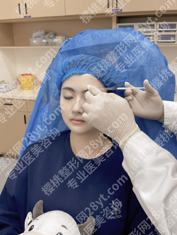 眉弓填充能维持多久?内行人实话实说,附3种材料真实维持数据