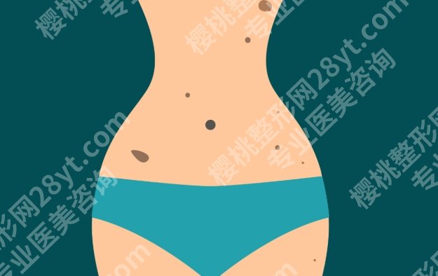 厦门吸脂专家排名榜，腰腹/大腿/手臂塑形口碑医生推荐，附大致费用区间