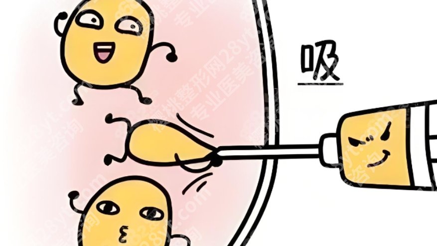 苏州吸脂做得好的专家，深扒这几位专家，拒绝凹凸不平，想瘦必看！