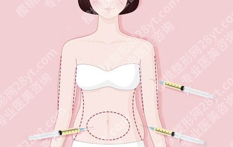 无锡吸脂塑形哪里好？几家口碑医院对比，告诉你差别有多大