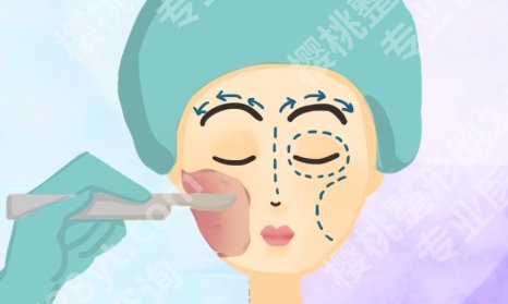广州南方医科大学整形科，招牌项目价格表及真实术前术后对比图一文看懂