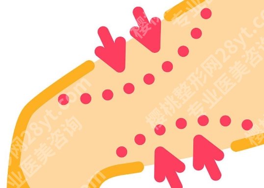 广州大腿吸脂手术价格,医院档次、抽脂量多少怎么影响费用?