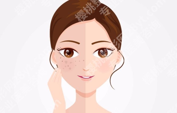 上海华东医院点阵激光怎么样？面诊评估、能量选择、疗程规划一览
