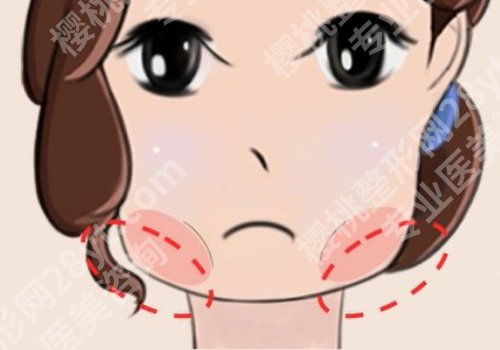 上海九院磨骨多少钱？2w元起、团队实力强，真实案例测评+新价格表