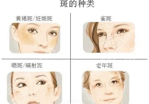 北京协和医院自体脂肪隆胸价格是多少？2w元起、设备全、技术稳靠谱