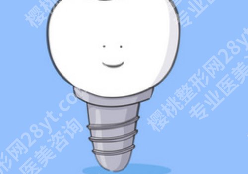 西京医院牙齿种植价格是多少？7k元起、附口碑项目优势+常见问题解答