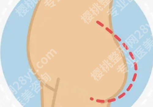 北京协和医院脂肪填充多少钱？8k起！附项目优势及常见问题解答