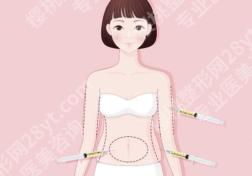 八大处吸脂手术价格更新！性价比高，低于3w起！