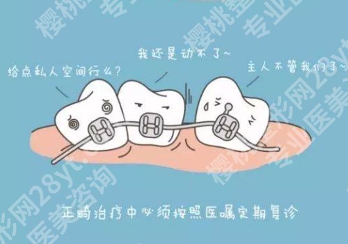 上海九院正畸费用一览表公开|科室核心项目分享