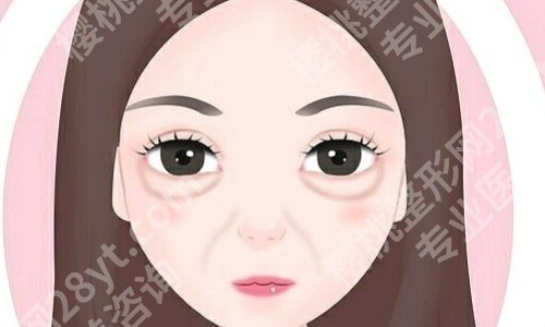 西安西京医院眼袋手术价位是多少？低至于5300元起，技术和案例欣赏