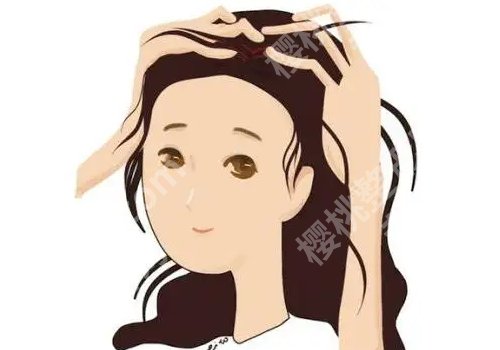 西京医院植发找哪个医生？窦文婕、薛萍口碑超好！