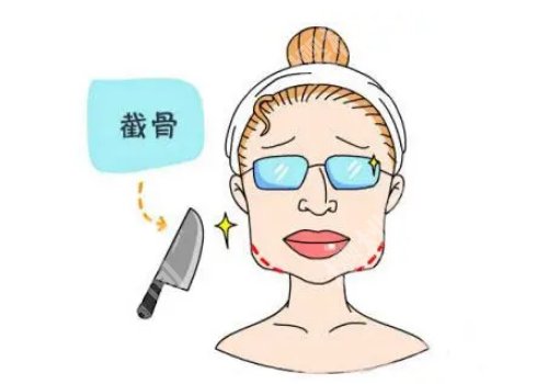 北京八大处磨骨手术多少钱？2w元起，一起看项目优势+顾客评价