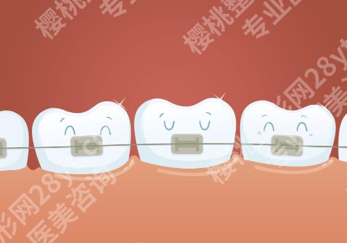 八大处牙齿矫正多少钱？大概1.5万元起、热门项目优势解析、顾客反馈