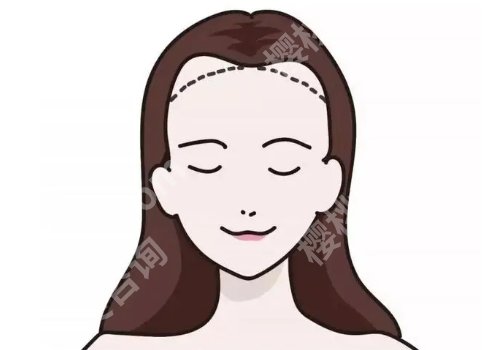 西安西京医院植发挂什么科？整形外科！基本信息+顾客点评一览！