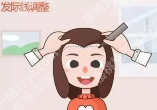 八大处植发费用多少？8000元起，价格明细|人气医生|网友点评